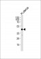 HAVCR1 Antibody